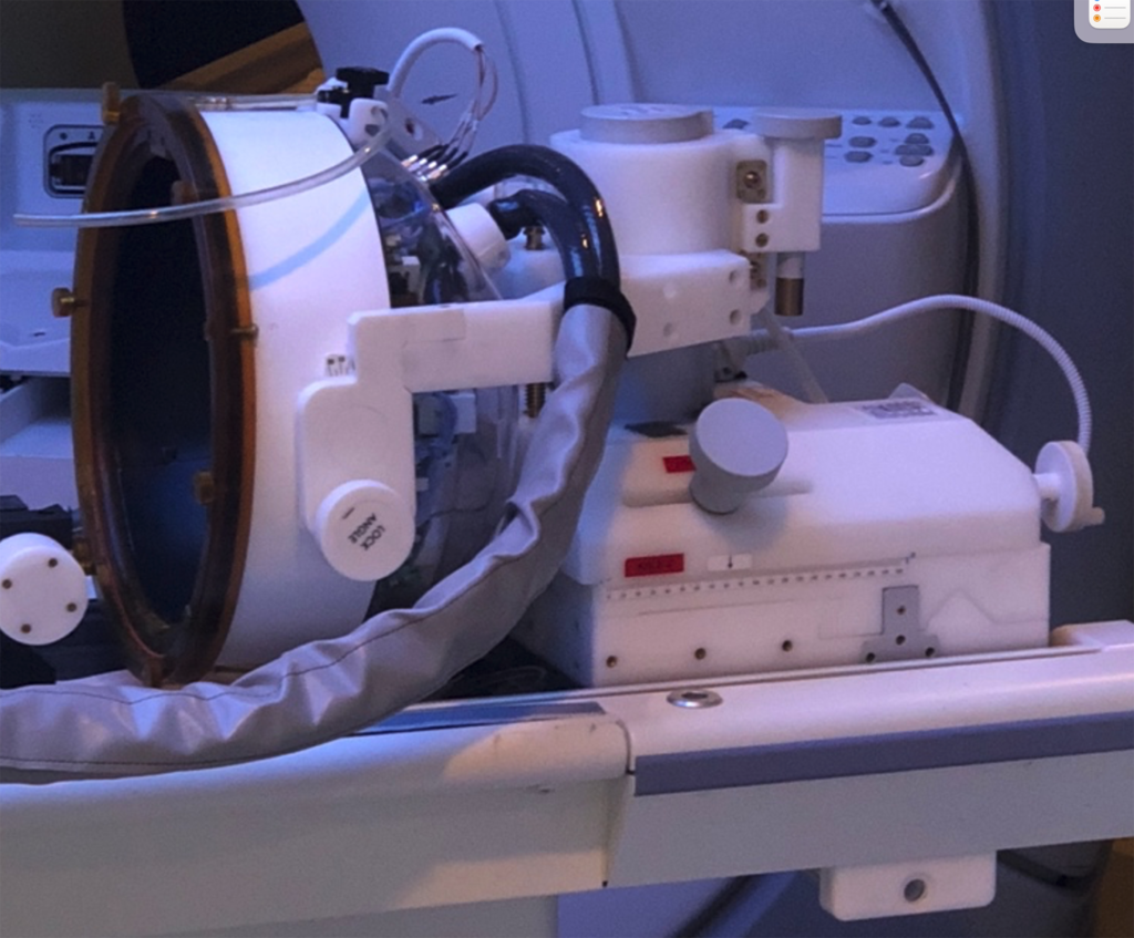 The ExAblate Neuro FUS system is used in
conjunction with magnetic resonance imaging
(MRg) to guide the direction of the
sonodynamic therapy waves to an internal
target, such as a brain tumor.