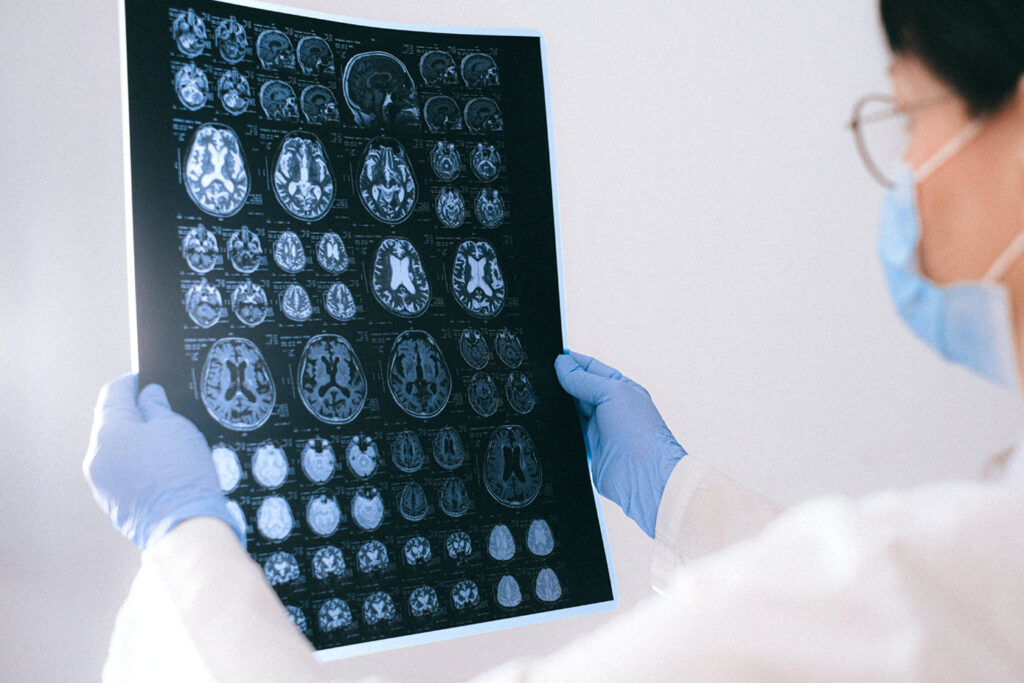 A research scientist studying brain imaging results from a patient